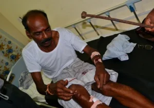 ஐ.நாவில் இலங்கை அரசின் வாக்குறுதிக்கு மத்தியில் வவுனியாவில் மனித உரிமை ஆர்வலர் மீது இரும்பு கம்பிகளால் கொடூர தாக்குதல்
